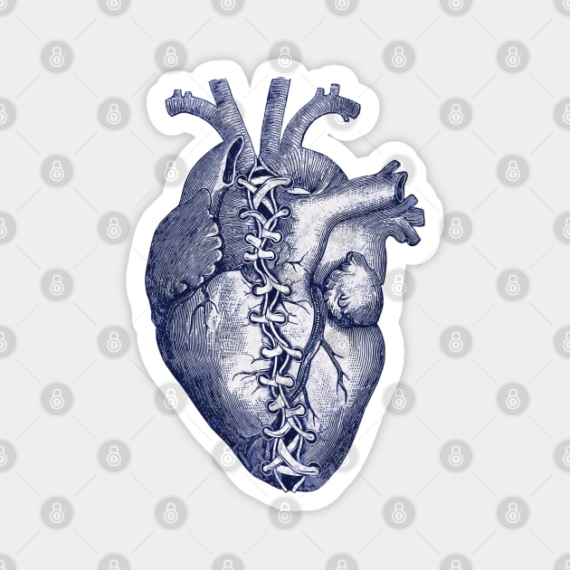 Blue Broken heart, Human heart illustration art, laces, tied heart, sewn heart Magnet by Collagedream