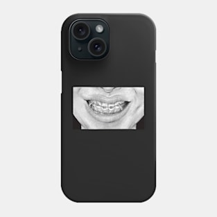 drawing insecurities braces teeth body positivity Phone Case