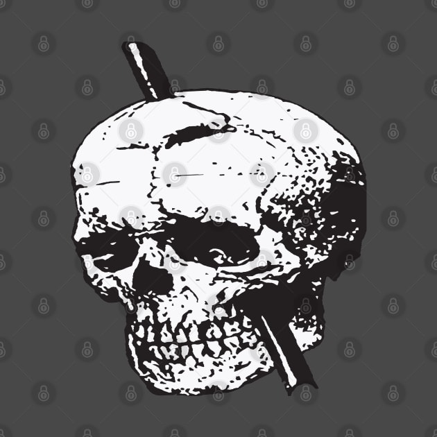 Black and White Skull of Phineas Gage With Tamping Iron by taiche