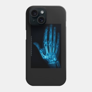 X-Ray Hand Phone Case