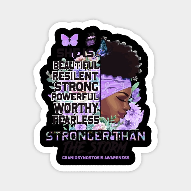 Craniosynostosis Awareness Black Girl Stronger than the storm Support Gift Magnet by Benjie Barrett