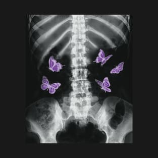 Egirl Xray Skeleton Purple Butterfly y2k Dark Edgy Grunge T-Shirt
