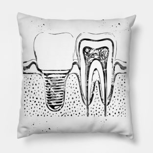 Human teeth and dental implant Pillow