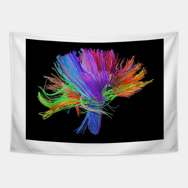 White matter fibres of the human brain (C023/9414) Tapestry by SciencePhoto