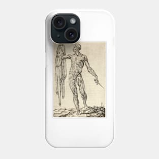 Dissected cadaver with flayed skin (C019/7086) Phone Case