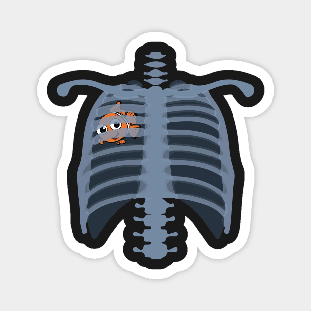 Nemo Thorax (Pneumothorax) Magnet by bwoody730