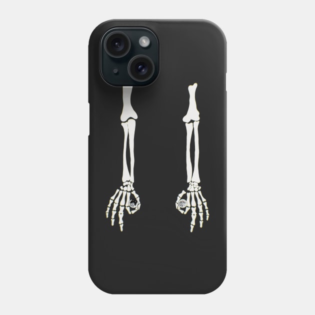 Hand Bones Suspenders With Moon Phone Case by xsaxsandra