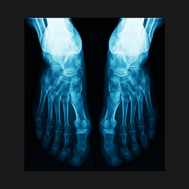 X-Ray Feet by mooonthemoon