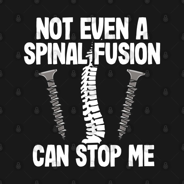 Back Surgery Not Even A Spinal Fusion Can Stop Me by Kuehni