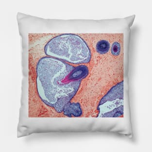 Dermoid ovarian cyst, light micrograph (C019/9256) Pillow