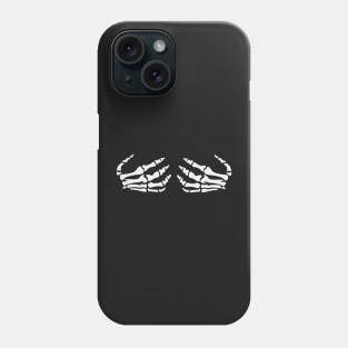 Skeleton Hands on chest Phone Case