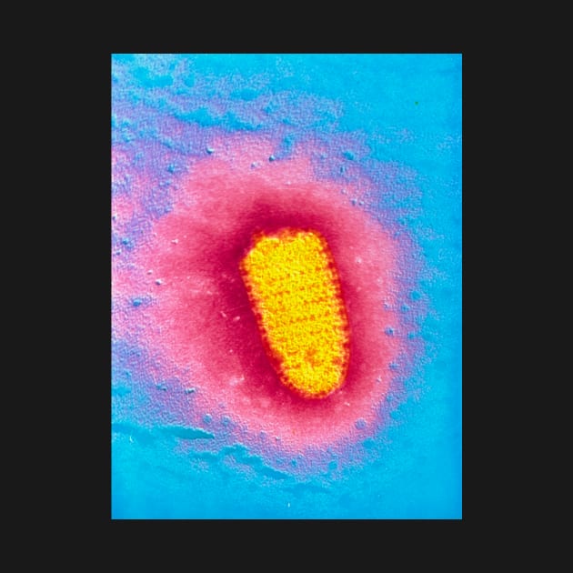 TEM of rabies virus (M050/0056) by SciencePhoto