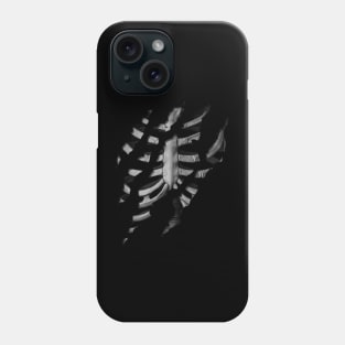 Heart Surgery Phone Case