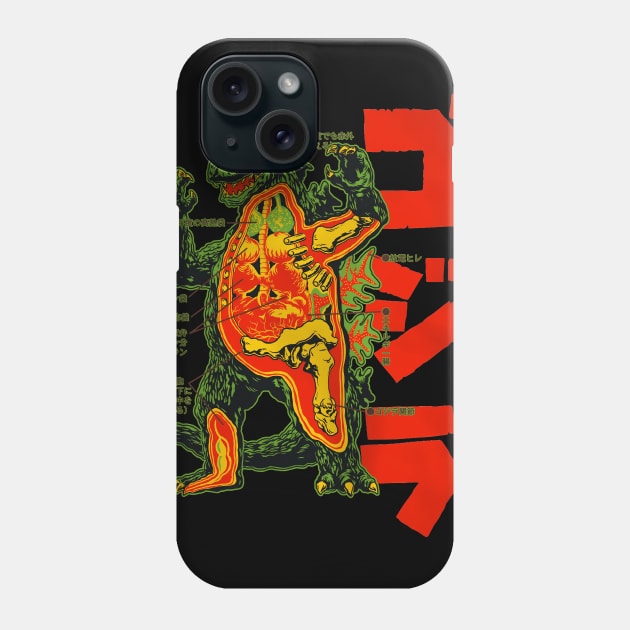 Kaiju Autopsy! Phone Case by SkipBroTees