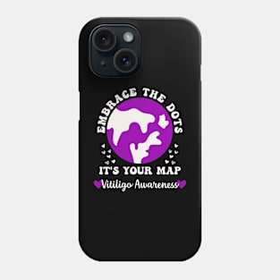 Vitiligo Awareness Embrace the Dots Vitiligo Acceptance Phone Case