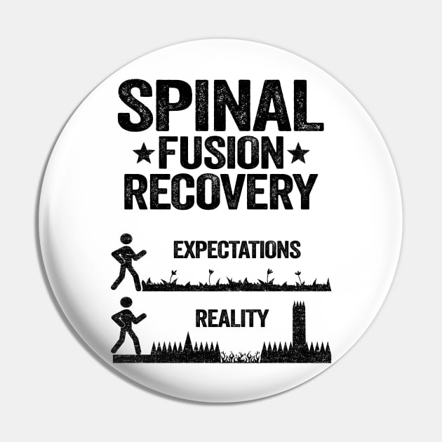 Bionic Spine Surgery Lumber Spinal Fusion Back Recovery Pin by Kuehni