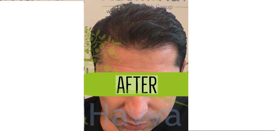 Adem & Havva Clinic after_4.jpg