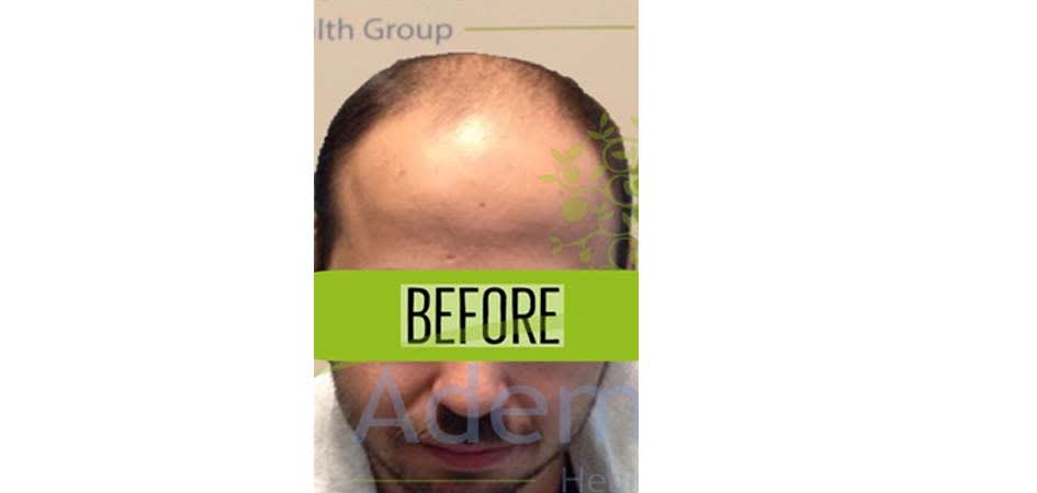 Adem & Havva Clinic before_3.jpg
