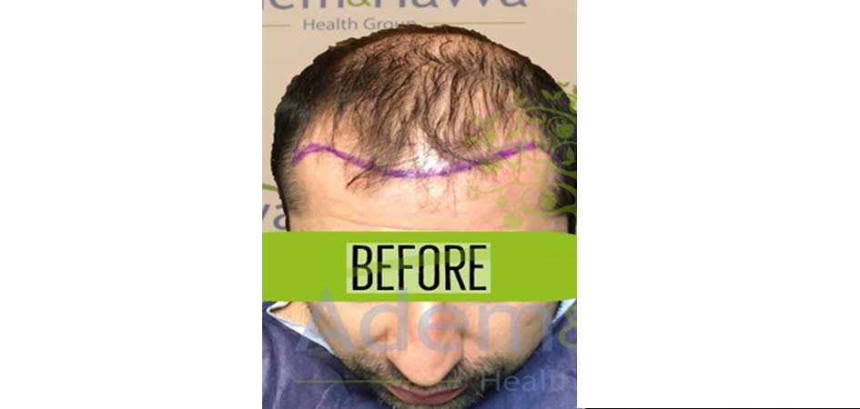 Adem & Havva Clinic before_4.jpg