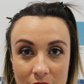 DHI Brisbane Clinic after_1.jpg