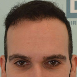 DHI Brisbane Clinic after_3.jpg