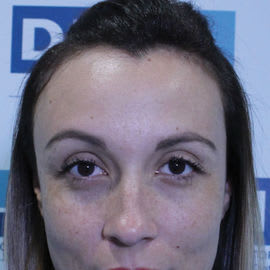 DHI Brisbane Clinic before_1.jpg