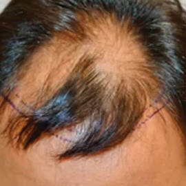 DHI Brisbane Clinic before_2.jpg