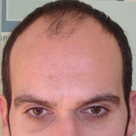 DHI Brisbane Clinic before_3.jpg
