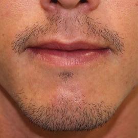 DHI Brisbane Clinic before_4.jpg