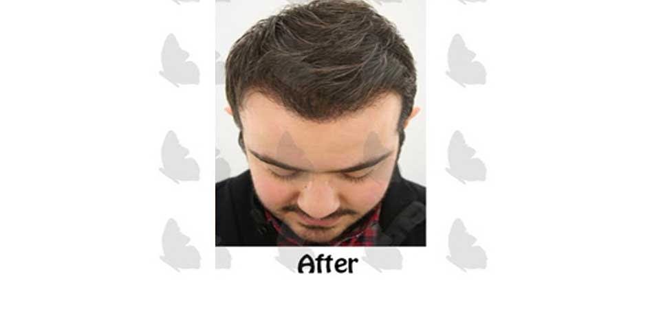 Estetik International estetik_after2.jpg