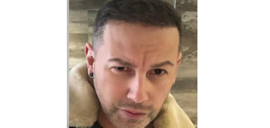 Esthetic Hair Turkey after_1.jpg