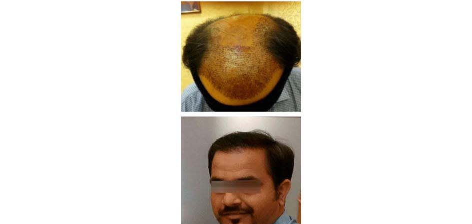 Kalosa after_1.jpg