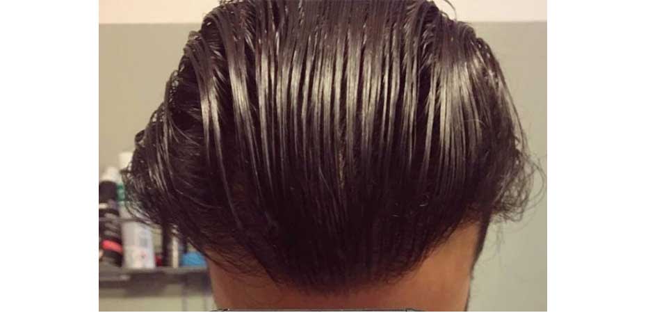 Smile Hair Clinic smilehair_after2.jpg