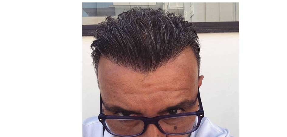 Smile Hair Clinic审查 Smile Hair Clinic审查