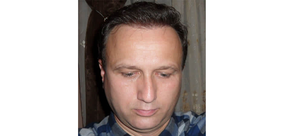 TMH Turkey Medical Health after_1.jpg