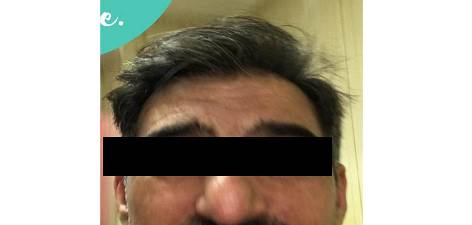 TMH Turkey Medical Health after_3.jpg