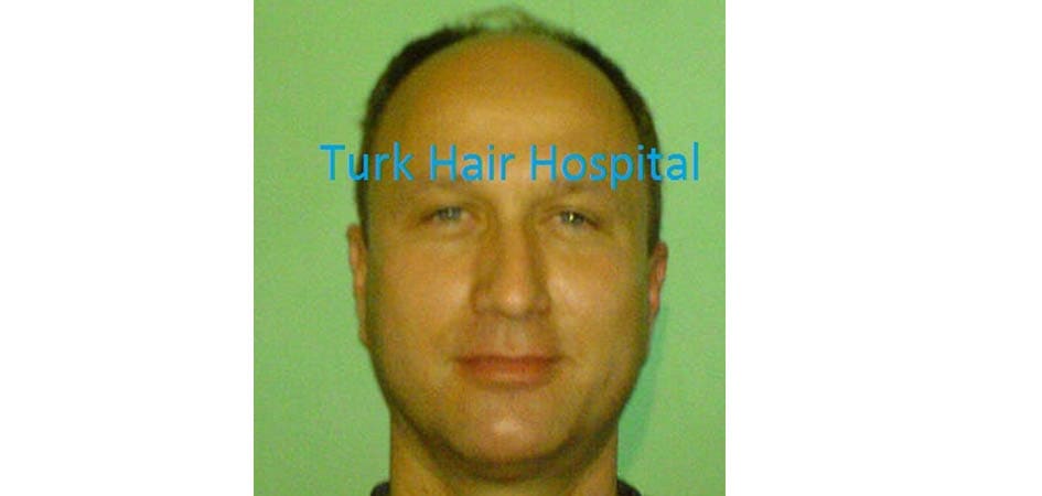 TMH Turkey Medical Health before_1.jpg