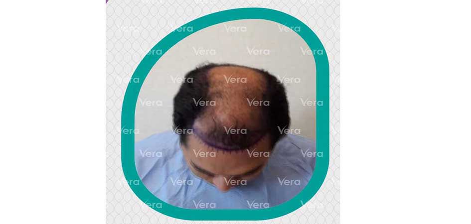 Vera Clinic vera_before3.jpg