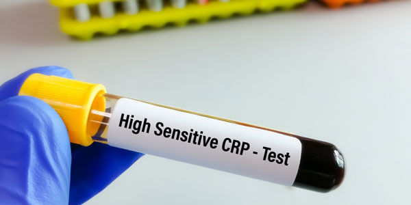 Sampel Test hs-CRP