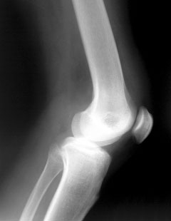 A knee x-ray, NHS is not perfect