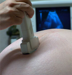 Pregnant woman receiving an ultrasound