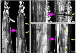 High-Energy X-Rays Trace Destruction In Bone Samples