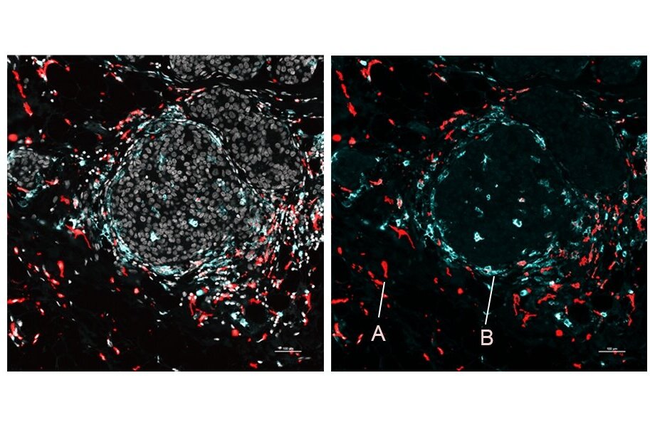 Gene Activity And Proteins Across Tissues