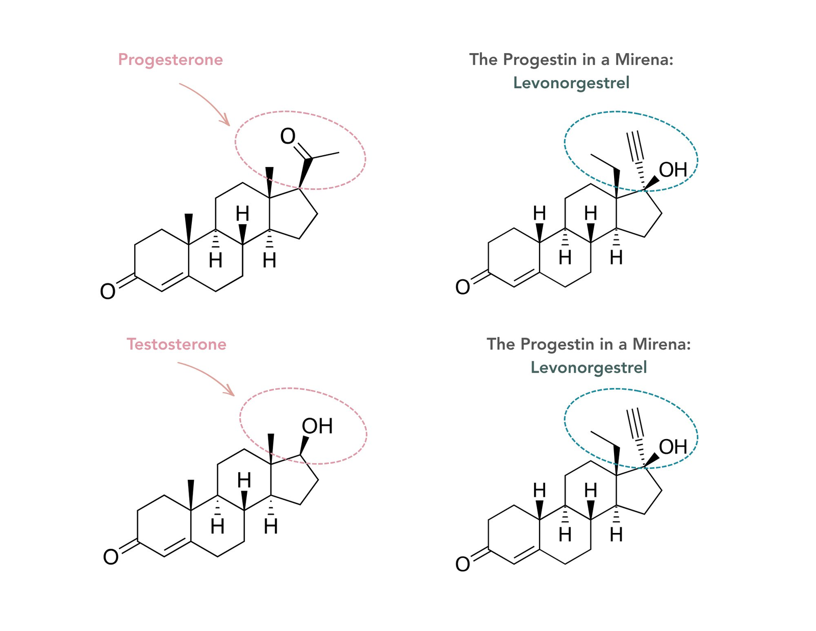 Molecular structure comparison showing progesterone, testosterone, and levonorgestrel (the progestin in a Mirena). Levonorgestrel more closely resembles testosterone than progesterone.