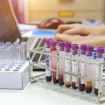 Cell-Testing: A simple test can help you avoid some very scary diseases. Cell testing is available at every Florida Wellness Medical Group location. For more information on disease prevention, call our offices at: (844) 935-5669