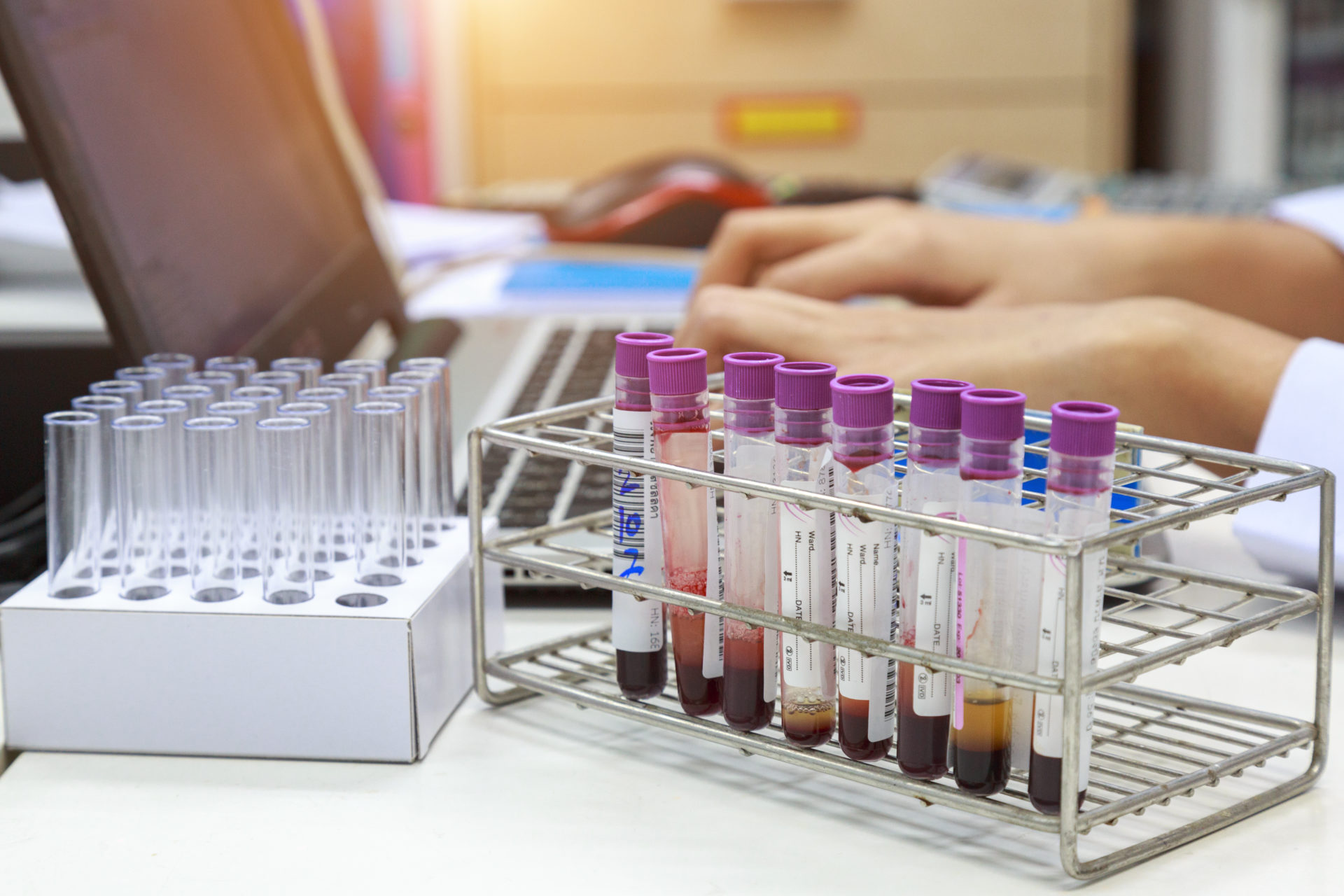 Cell-Testing: A simple test can help you avoid some very scary diseases. Cell testing is available at every Florida Wellness Medical Group location. For more information on disease prevention, call our offices at: (844) 935-5669