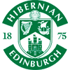 Hibernian Edinburgh