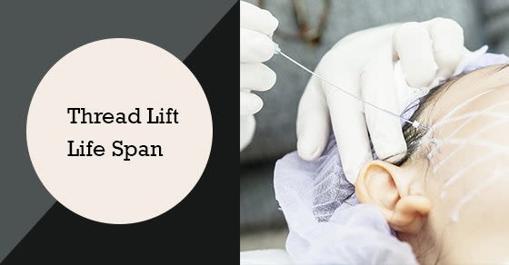 How Long Do The Results Of Thread Lifts last?