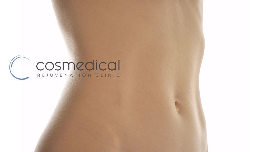Difference Between a Belt Lipectomy and an Extended Tummy Tuck?