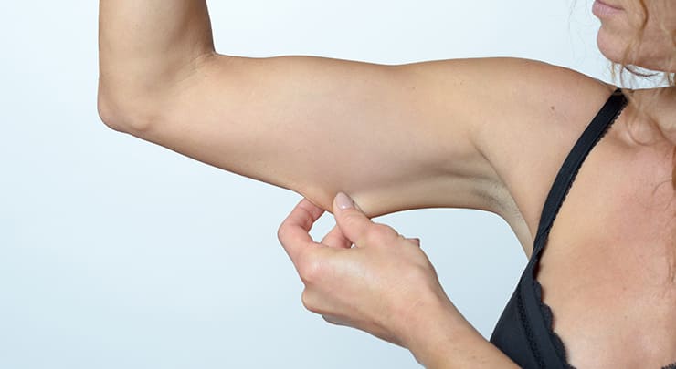 Arm Lift And Brachioplasty For Leaner Meaner Arms To Show Off Arm Lift And Brachioplasty For Leaner Meaner Arms To Show Off